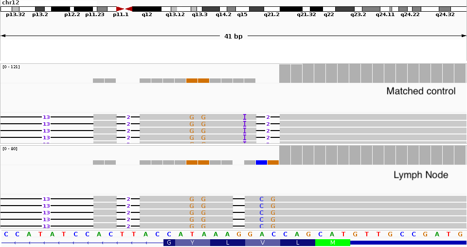 IGV showing tumor vs normal comparison