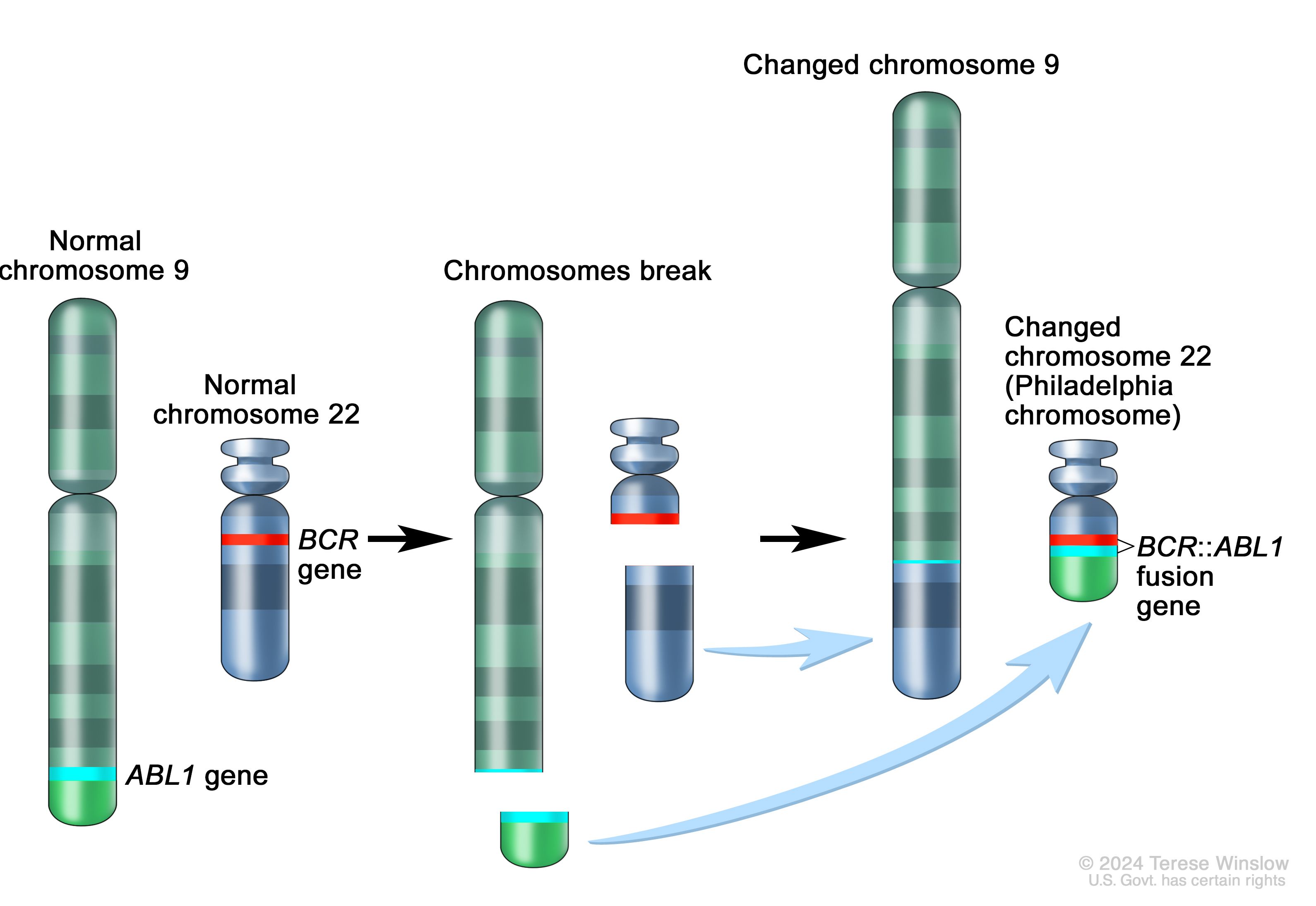 Diagram of BCR-ABL1 gene fusion from chromosomal translocation t(9;22)